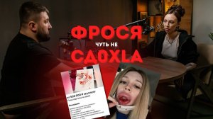 Дария Умнова- ФРОСЯ| Сперма губы, картина и ногти с месячными | Сколько зарабатывает на черном хайп?