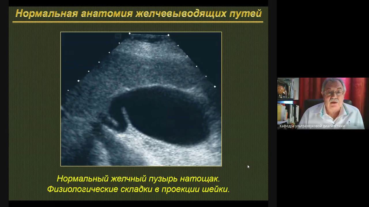 УЗД заболеваний ЖВП 1  Неласов Н Ю