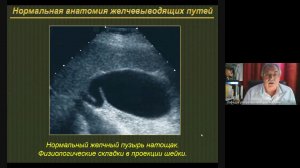 УЗД заболеваний ЖВП 1  Неласов Н Ю