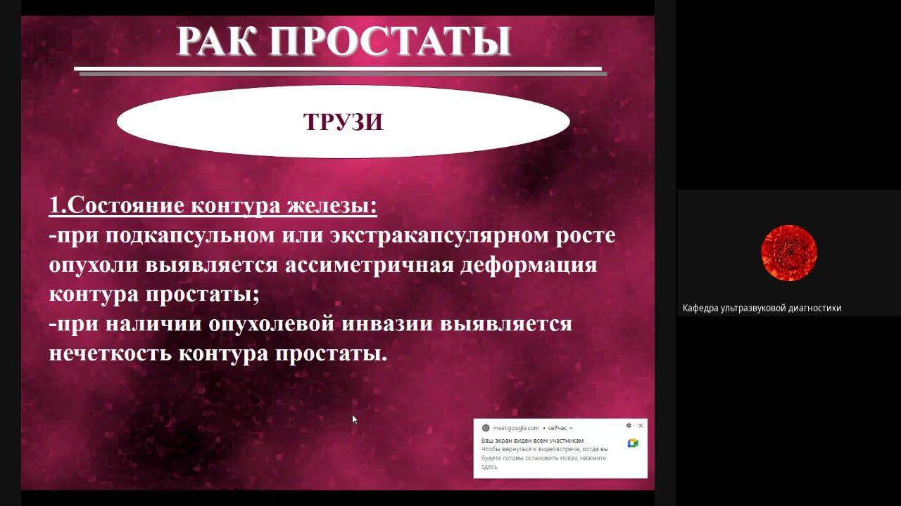 УЗД заболеваний предстательной железы  Часть 2  Паленый А И