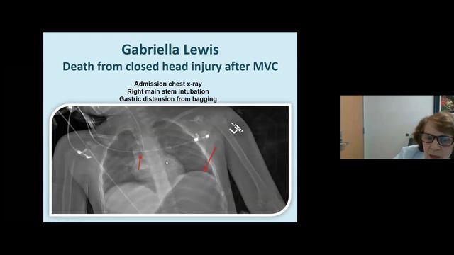 "Pediatric Trauma", Lesli Taylor, MD смотреть онлайн