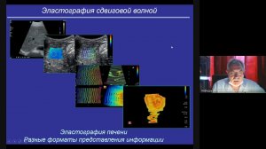 Лекция  Введение в УЗД  часть 3  зав каф проф  Неласов Н Ю