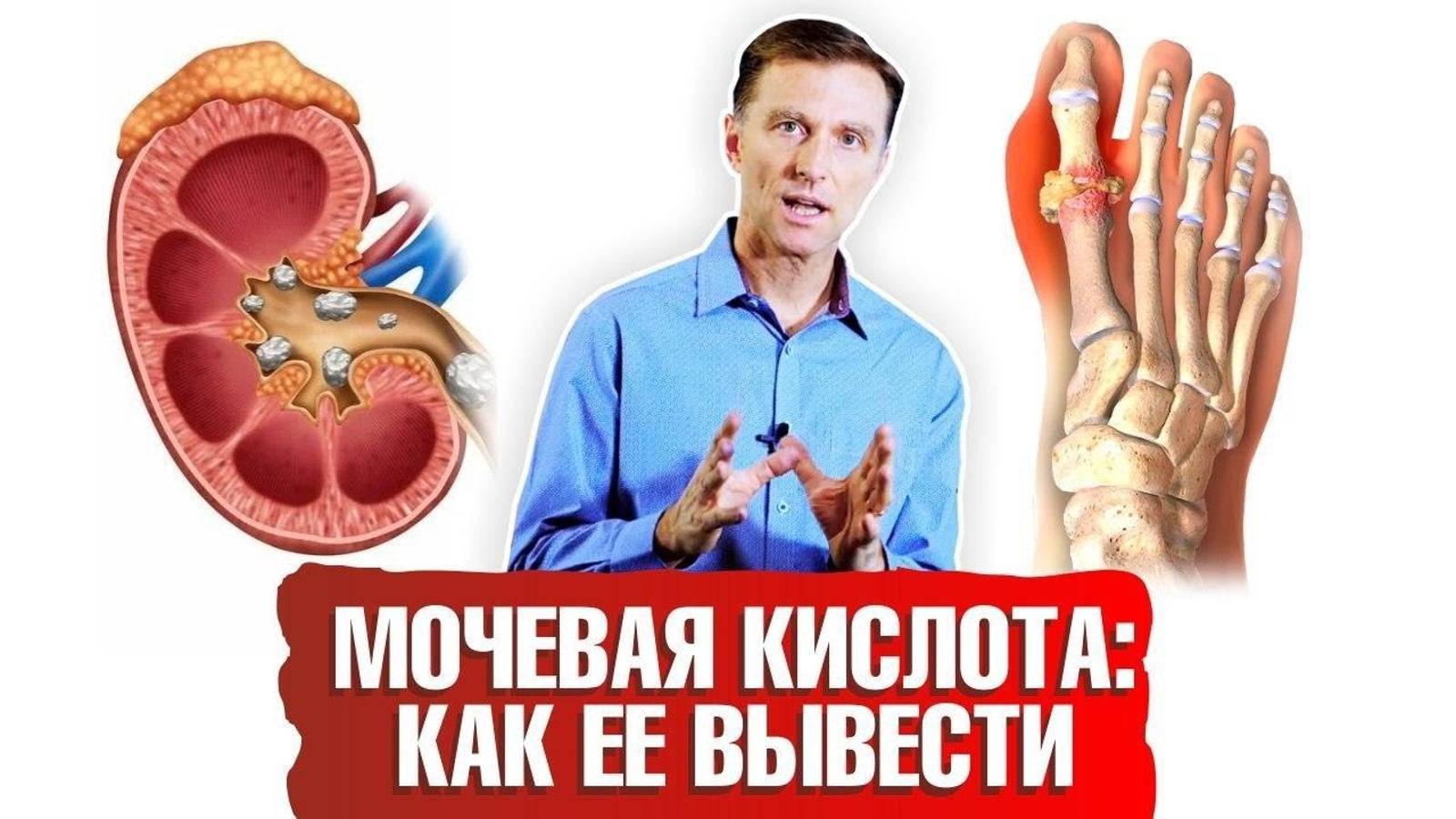 Мочевая кислота. Как вывести ее из организма? ☝️