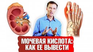 Мочевая кислота. Как вывести ее из организма? ☝️