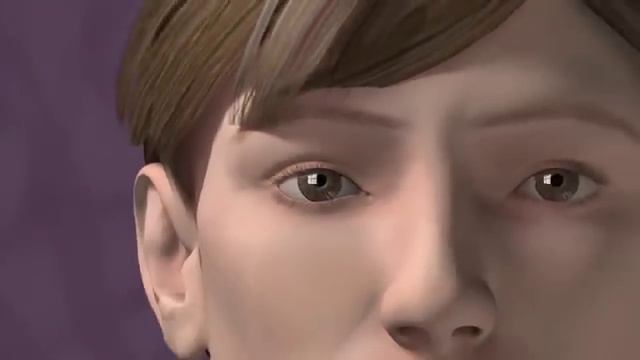 Migraines and Vertigo - Mayo Clinic смотреть онлайн