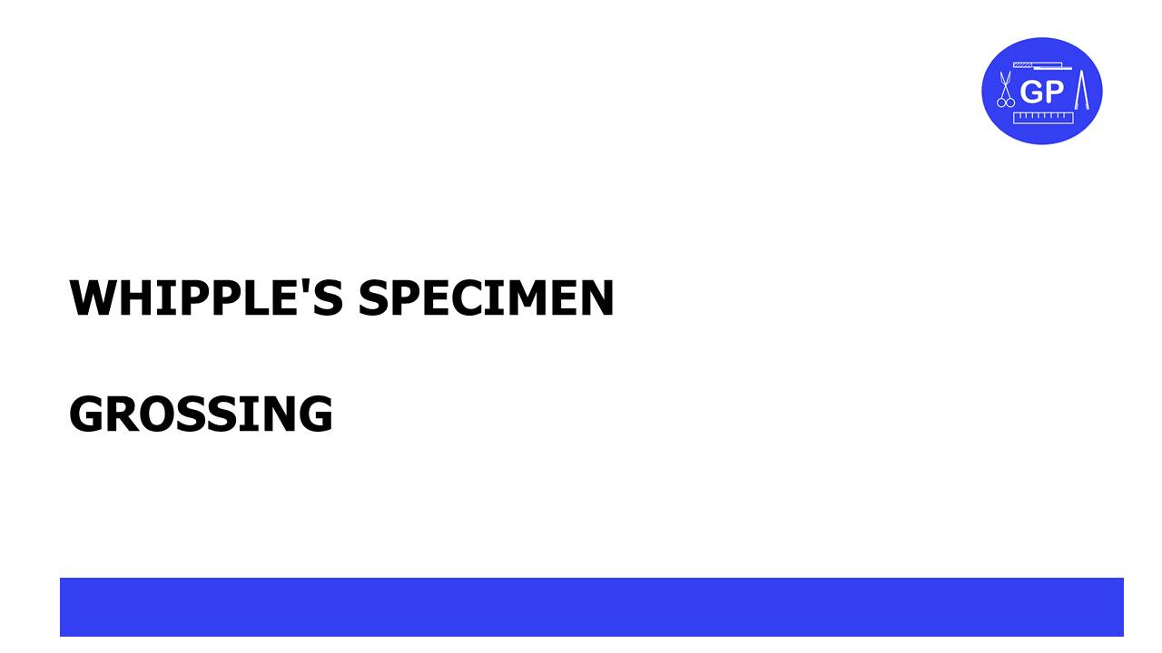 Whipple Specimen Gross (pathology)