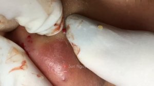 Satisfying and Relaxation with SURI NGUYEN Beauty Spa Video #175