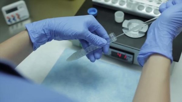 ARTIFICIAL INSEMINATION.