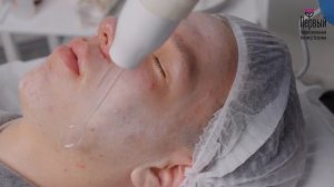 11 Видеоурок по теме- "Аппаратные методы в косметологии. Дарсонвализация"