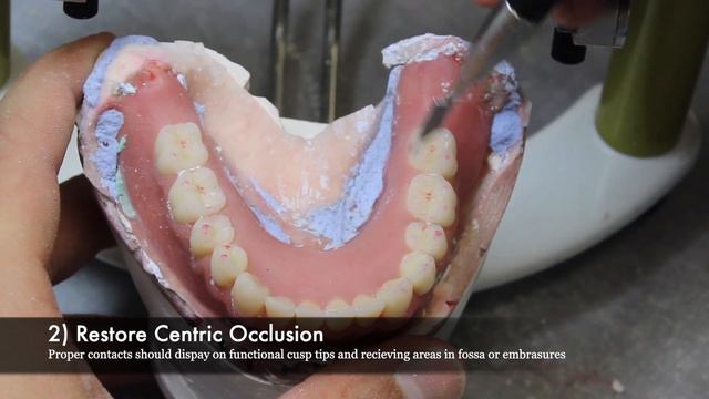 Complete Dentures - Selective Grinding Step-by-Step смотреть онлайн