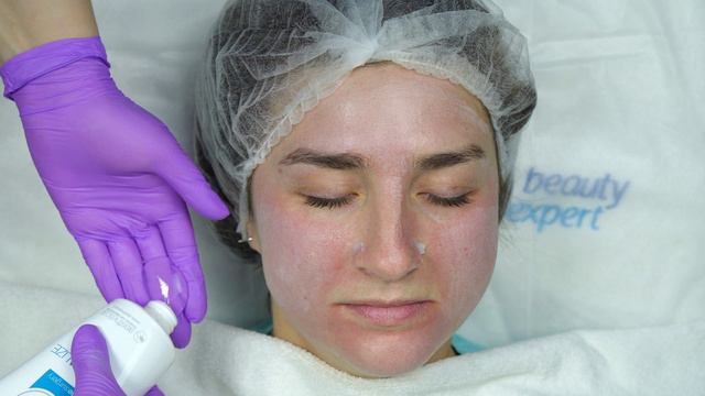 Видеопротокол Skin Revive