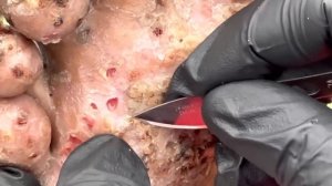 Sobi has small jiggers and a soft skin; you'll see WHOLE JIGGERS - full video @riseupsociety.net