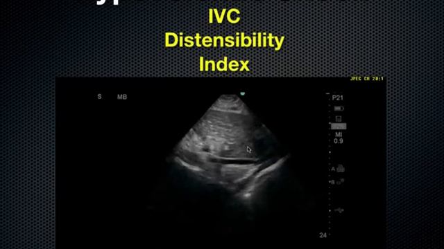 Critical care Ultrasound:RUSH exam смотреть онлайн