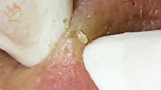 Enjoy Every Day With The Best Video Loan Nguyen Spa New Office #Spa075