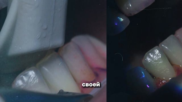 Грибкова Марина Вячеславовна - стоматолог гигиенист команды OneDent