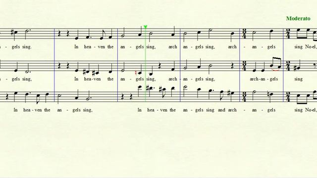 Sweelinck - Hodie Christus Natus Est - Soprano Part (arr. by Peter Selden).wmv смотреть онлайн