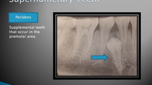 Radiographic Interpretation of Dental Anomalies Part 1 смотреть онлайн
