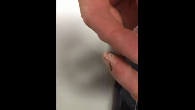 Suturing my own finger on night shift, Bernhard Racz смотреть онлайн