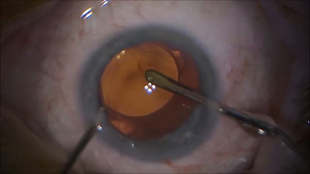 Primus HD Yellow 2.2 mm смотреть онлайн