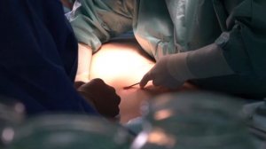 Липосакция живота, боков, подбородка. Подтяжка лица. DR.ANIMELOYAN