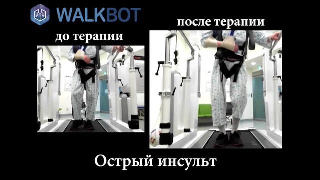 Кейс 1 Острый инсульт