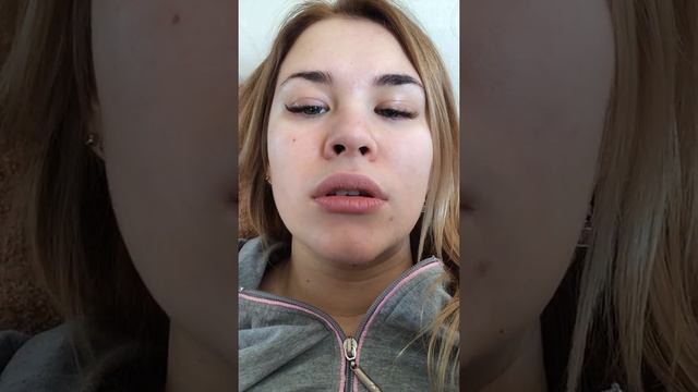 РАЗБИЛА ПОДБОРОДОК//ОПЕРАЦИЯ/ЗАШИВАЛИ/ШРАМ/ смотреть онлайн