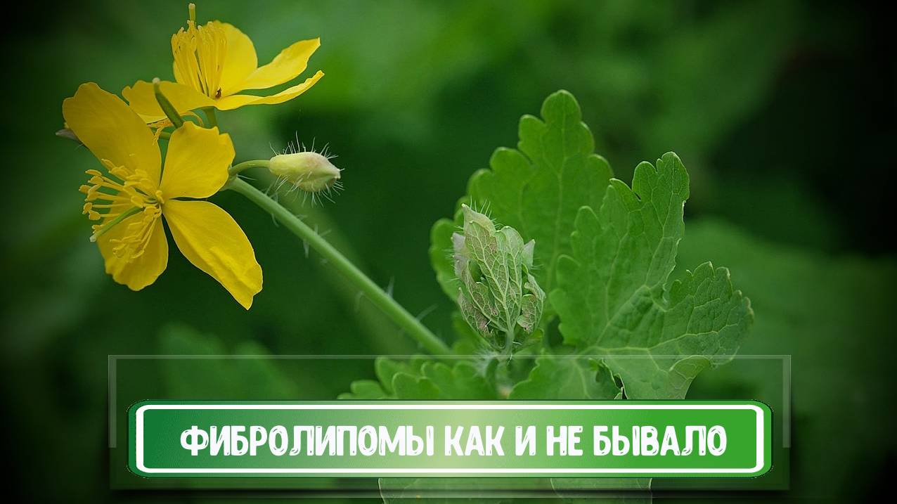 ФИБРОЛИПОМЫ КАК НЕ БЫВАЛО смотреть онлайн