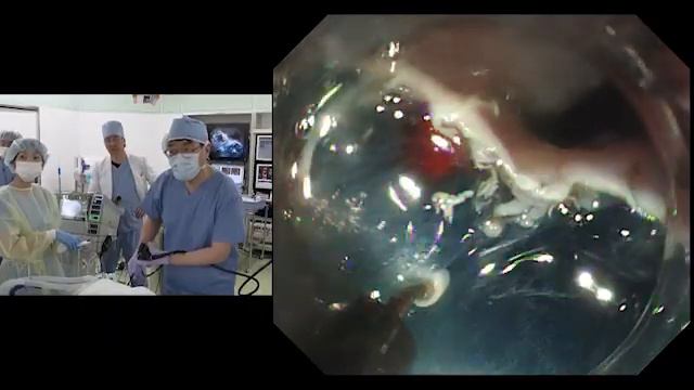 TOKYO Live 2019 Dr Hiroyuki Ono 2 2 смотреть онлайн