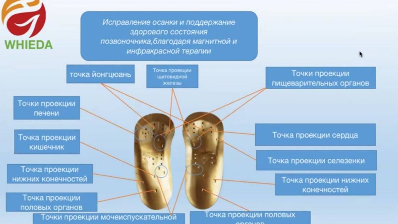 Для чего нужны магнитные стельки с анионами. Нормализуют проблемы, вызванные искривлением костей. смотреть онлайн
