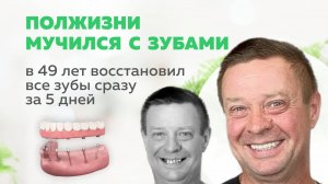 Мучился с зубами полжизни. Обрел новую улыбку за 5 дней | Стратегическая имплантация во Владимире