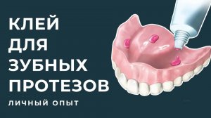 37. Dentures/Съемные зубные протезы: Клей для зубных протезов.