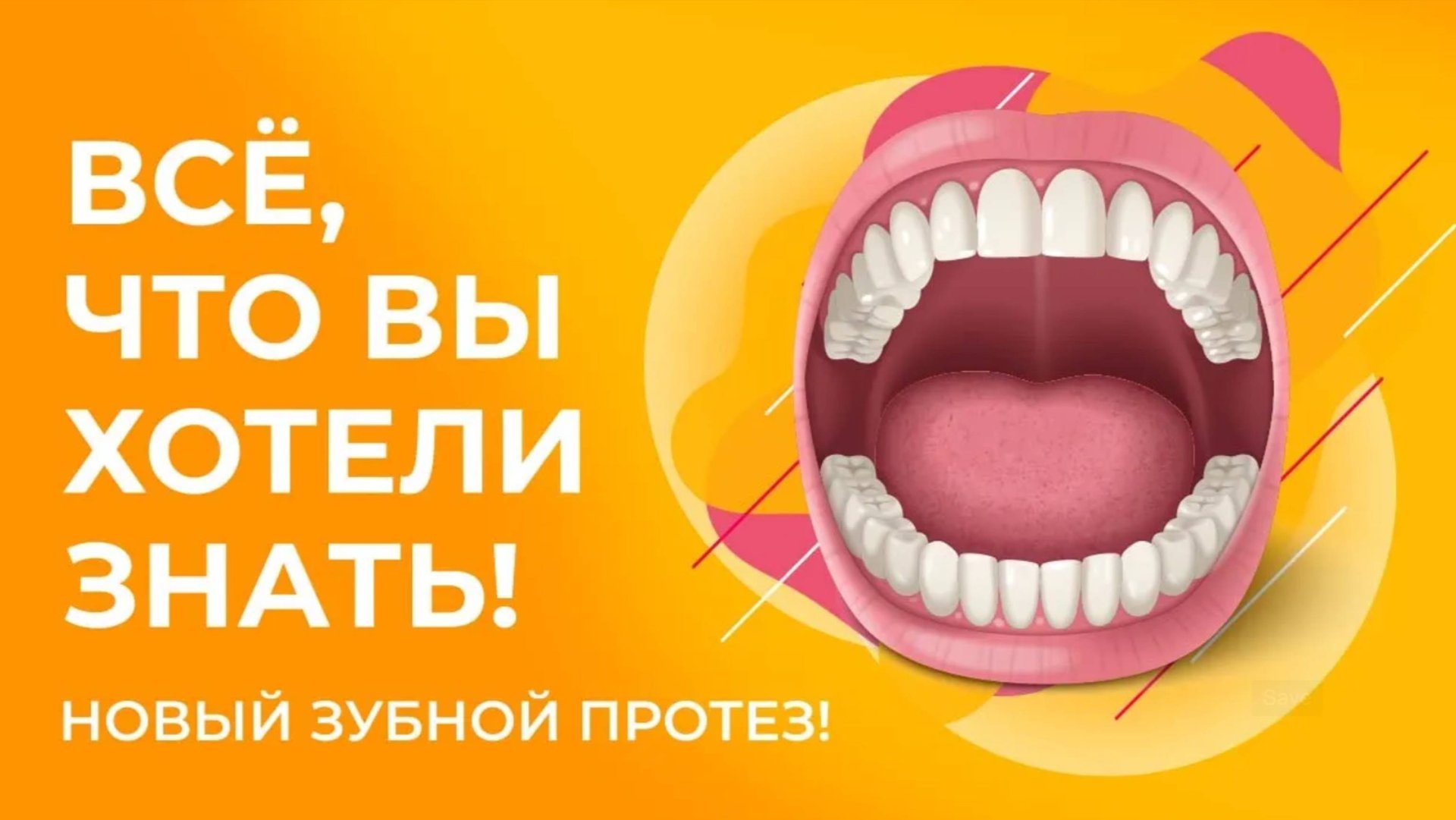 33. Dentures/Съёмные зубные протезы: Новый, третий зубной протез. смотреть онлайн