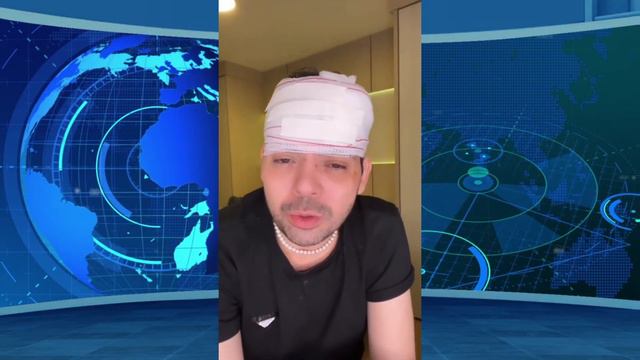 Humorista Gustavo Mendes sofre agressão brutal em tentativa de assalto