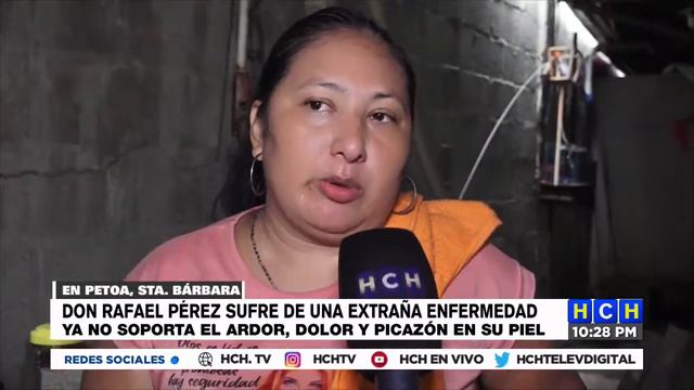 Don Rafael Pérez sufre de una extraña enfermedad en su piel, ruega por un diagnostico y tratamiento смотреть онлайн