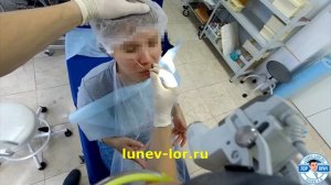 Лечение гайморита без прокола. Зондирование верхнечелюстных пазух через естественное соустье.