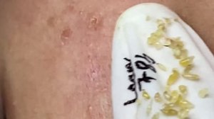 Enjoy Every Day With The Best Video Loan Nguyen Spa Official  2647