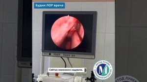 Гнойный гайморит.