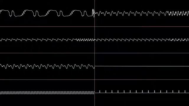 Jeroen Tel - Tintin On The Moon (Genesis Cover)