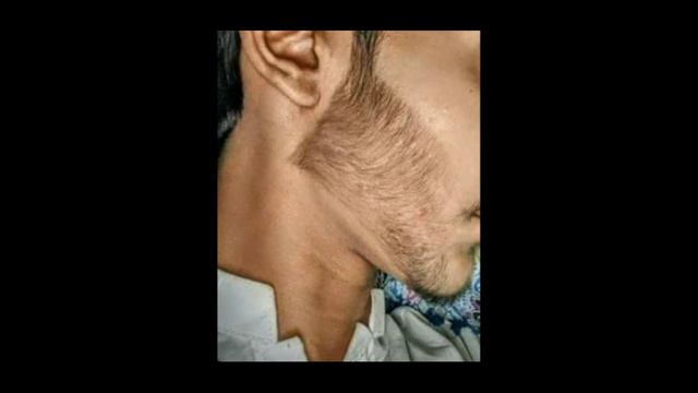 BEARD GROWTH 1MONTH BEARD RESULTS || दाढ़ी उगाए 1 मात्र महीने में || FAST BEARD GROWTH смотреть онлайн