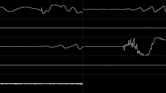 Masato Nakamura - "Sonic the Hedgehog 2 (Genesis/MD) - Casino Night Zone" [Oscilloscope View] смотреть онлайн