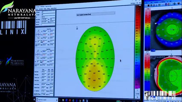 LIVE TOPOGRAPHY with Dr Michael Belin & Dr J Randleman PART 2 смотреть онлайн