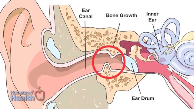 Lake Ear, Nose, Throat and Facial Plastic Surgery: Don't Stick It In Your Ear смотреть онлайн
