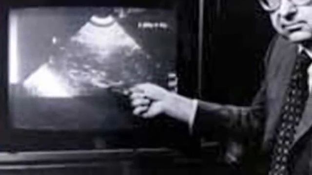 Muere Bernard Nathanson, médico pro-vida americano a los 84 años смотреть онлайн