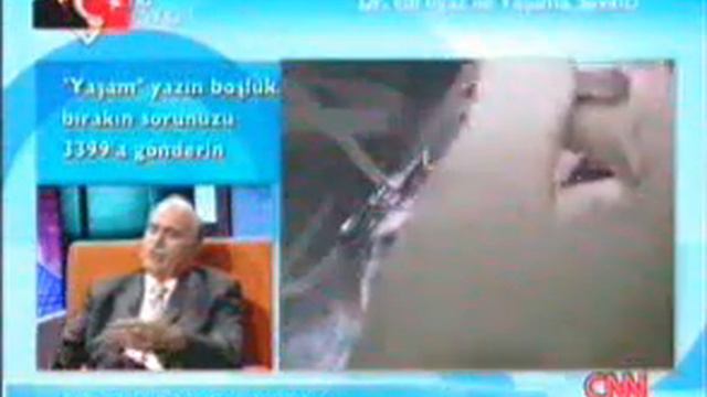 30 Lazer Yasama Sevinci Laser Tedavileriprof Pallikaris Ile Birlikte