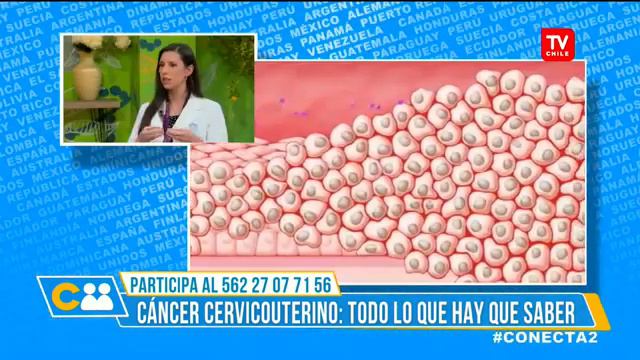 Cáncer cervicouterino es el que más afecta a mujeres en edad fértil смотреть онлайн