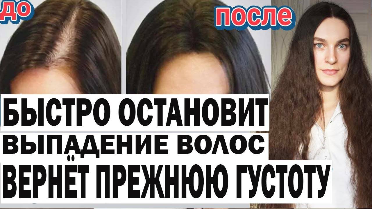 Бабушкино средство. УСКОРИТ рост волос и ОСТАНОВИТ выпадение смотреть онлайн