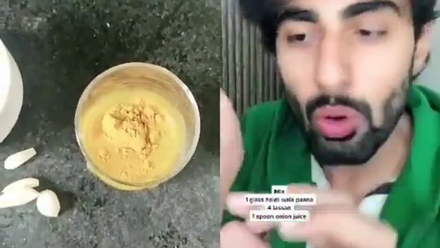 How To Get Rid Of Dandruff And Dry Scalp In Just 3 Days / Desi Nuskhe Dandruff Ku Hatane K Liye 202