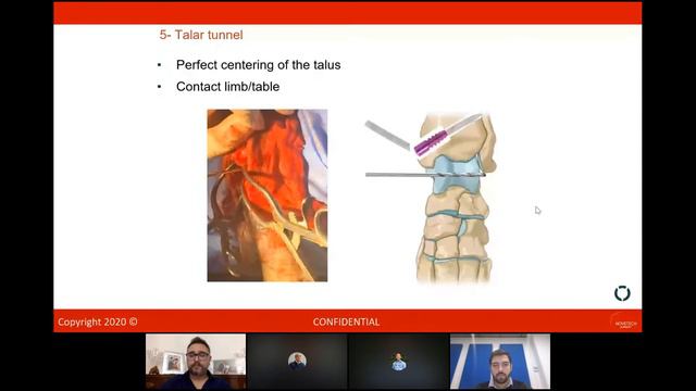 IGOS Webinar - 2020 Dec 17: Surgical treatment of tibio-tarsal instability by Dr Vincenzo Santoro смотреть онлайн