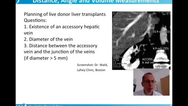 Medical Visualization - Interaction Techniques in Medical Volume Visualization (4) смотреть онлайн