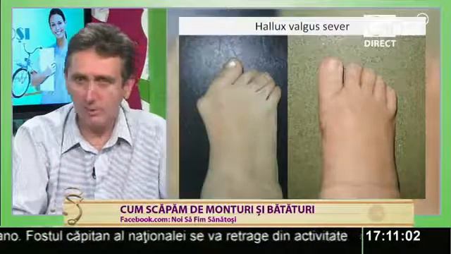 Monturi Si Bataturi: Marius Uscatu, Institutul Piciorului